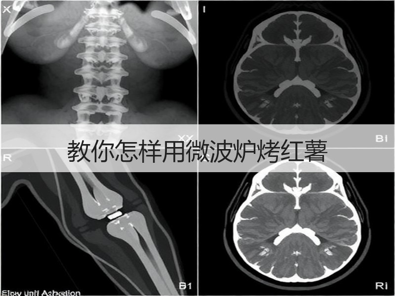 教你怎样用微波炉烤红薯