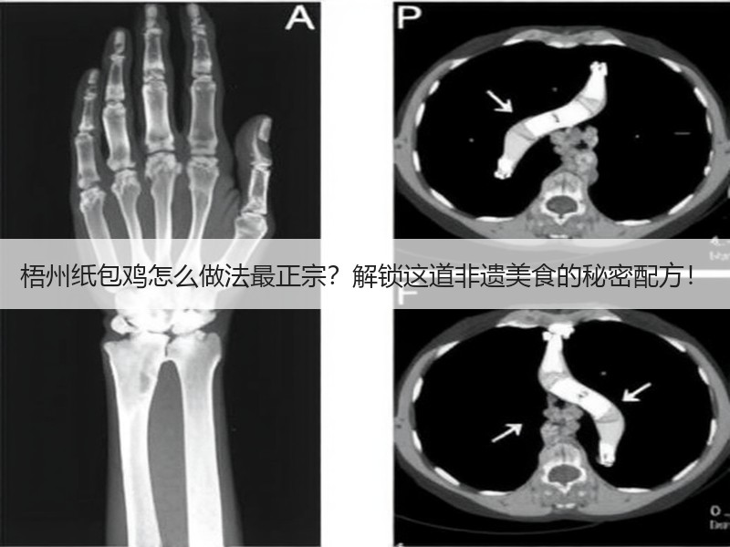 梧州纸包鸡怎么做法最正宗？解锁这道非遗美食的秘密配方！