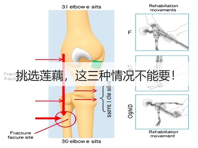 挑选莲藕，这三种情况不能要！